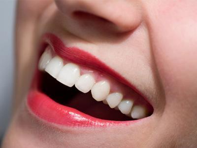 Ingin Gigi Putih dan Sehat? Ikuti Tips Ini!